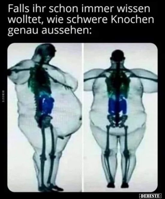 Falls ihr schon immer wissen wolltet, wie schwere Knochen.. - Lustige Bilder | DEBESTE.de