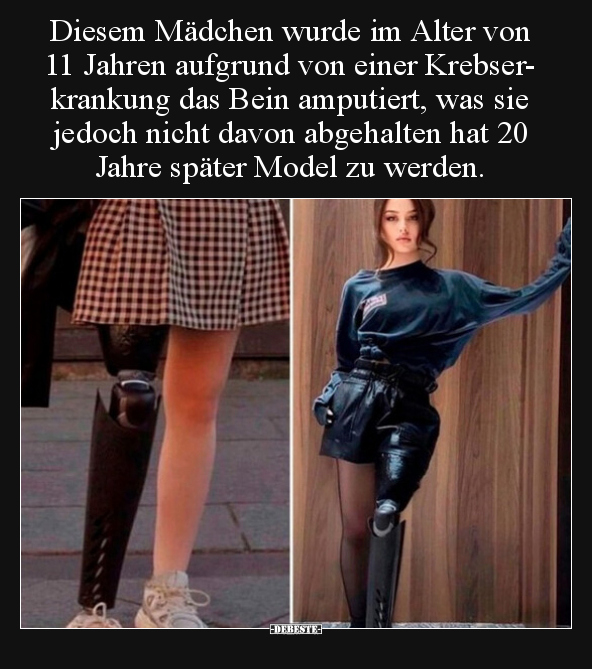 Diesem Mädchen wurde im Alter von 11 Jahren aufgrund von.. - Lustige Bilder | DEBESTE.de