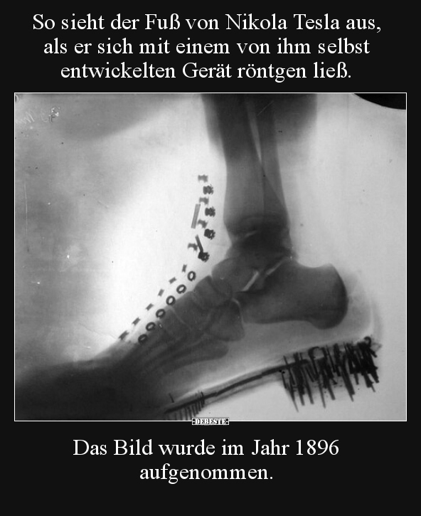 So sieht der Fuß von Nikola Tesla aus, als er sich mit.. - Lustige Bilder | DEBESTE.de