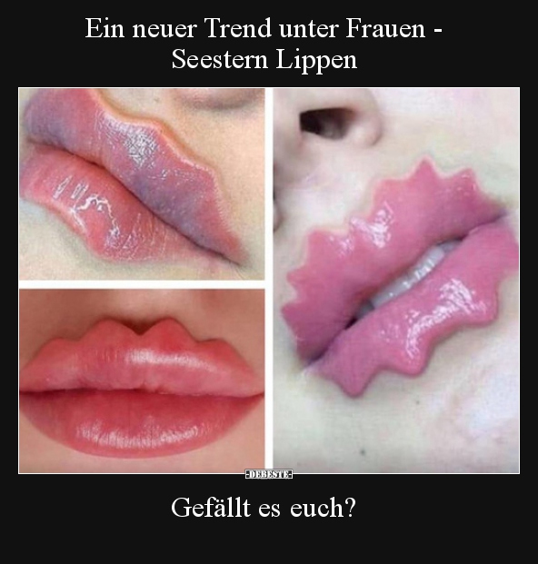 Ein neuer Trend unter Frauen - Seestern Lippen.. - Lustige Bilder | DEBESTE.de