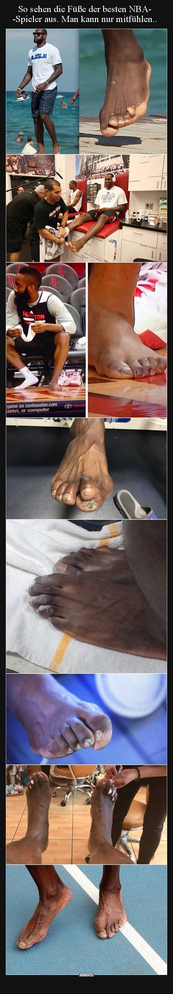 So sehen die Füße der besten NBA-Spieler aus.. - Lustige Bilder | DEBESTE.de