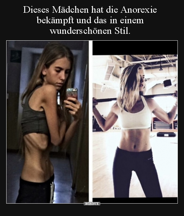 Dieses Mädchen hat die Anorexie bekämpft und das in einem.. - Lustige Bilder | DEBESTE.de