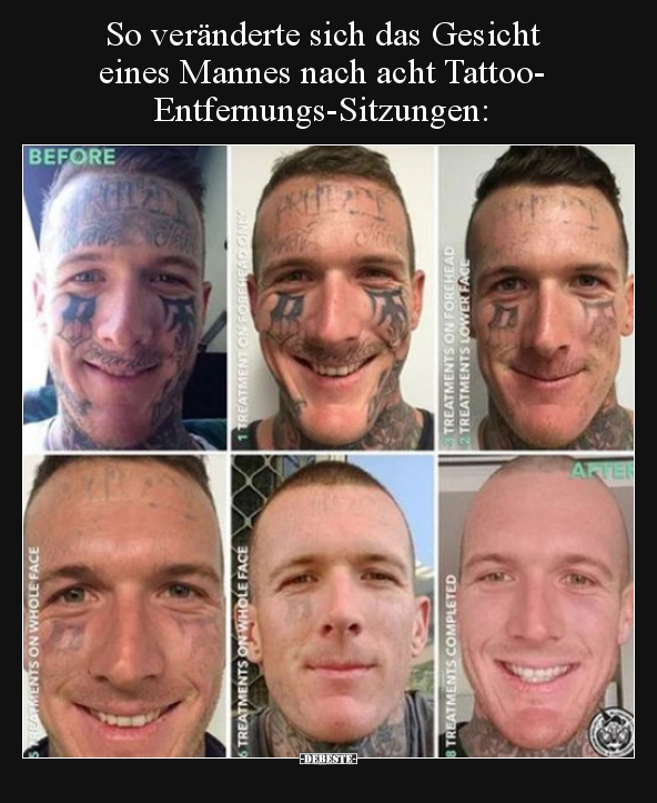 So veränderte sich das Gesicht eines Mannes nach acht.. - Lustige Bilder | DEBESTE.de