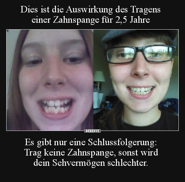Dies ist die Auswirkung des Tragens einer Zahnspange für.. - Lustige Bilder | DEBESTE.de