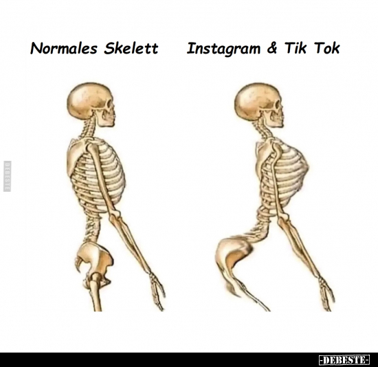 Normales Skelett - Instagram & Tik Tok.. - Lustige Bilder | DEBESTE.de