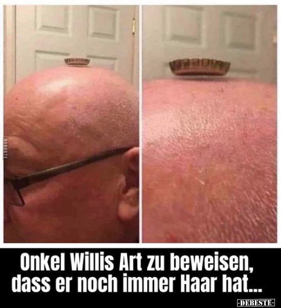 Onkel Willis Art zu beweisen, dass er noch immer Haar.. - Lustige Bilder | DEBESTE.de