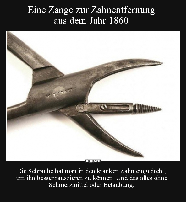 Eine Zange zur Zahnentfernung aus dem Jahr 1860.. - Lustige Bilder | DEBESTE.de