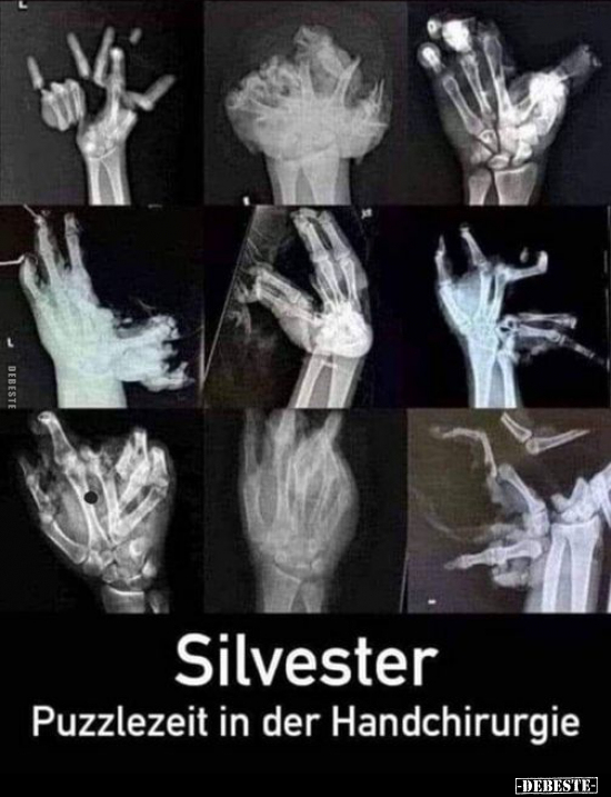 Silvester - Puzzlezeit in der Handchirurgie.. - Lustige Bilder | DEBESTE.de