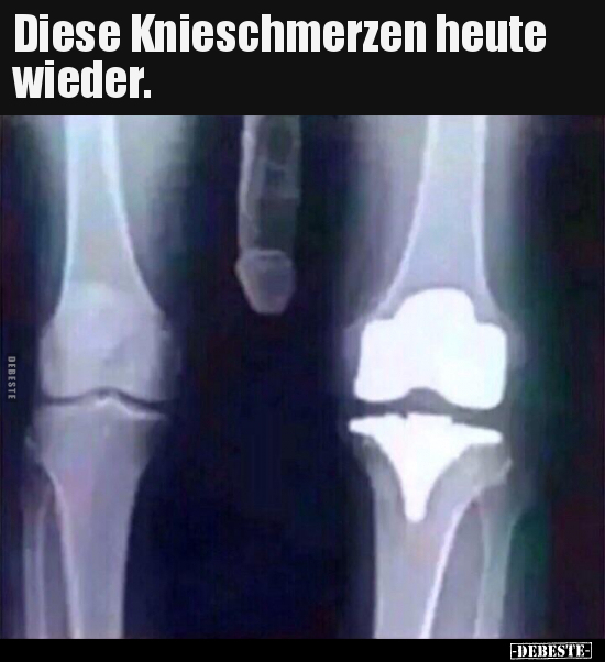 Diese Knieschmerzen heute wieder... - Lustige Bilder | DEBESTE.de