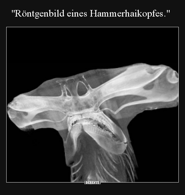 "Röntgenbild eines Hammerhaikopfes.".. - Lustige Bilder | DEBESTE.de