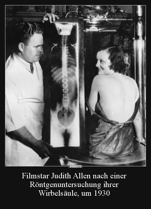 Filmstar Judith Allen nach einer Röntgenuntersuchung.. - Lustige Bilder | DEBESTE.de