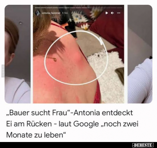 "Bauer sucht Frau" - Antonia entdeckt Ei am Rücken... - Lustige Bilder | DEBESTE.de