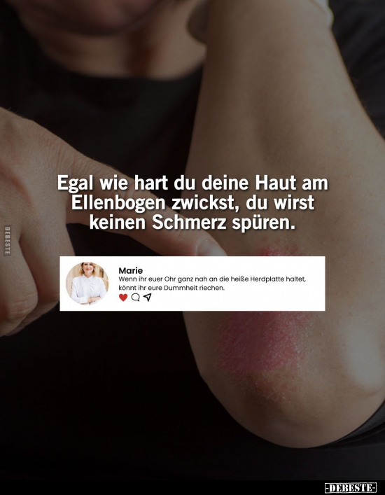 Egal wie hart du deine Haut am Ellenbogen zwickst, du wirst.. - Lustige Bilder | DEBESTE.de