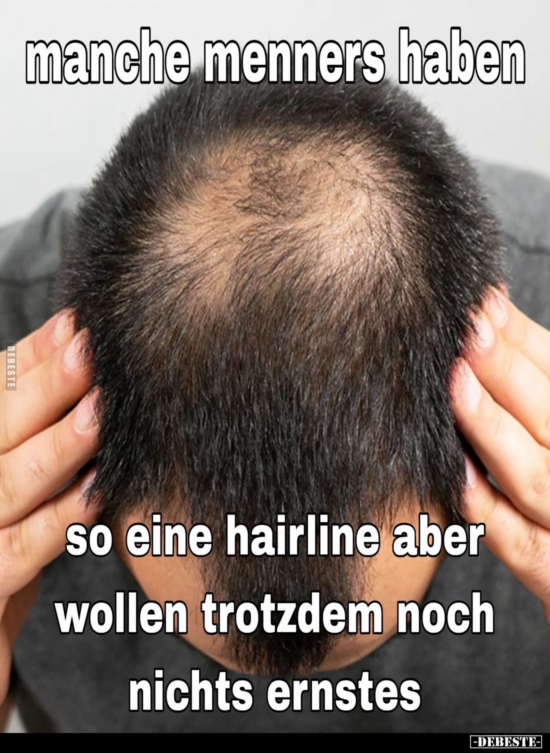 Manche Menners haben so eine Hairline aber wollen trotzdem noch nichts Ernstes