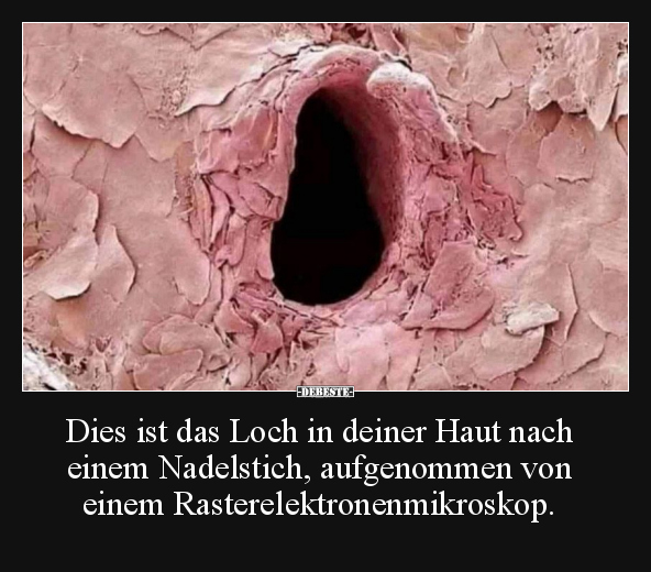 Dies ist das Loch in deiner Haut nach einem Nadelstich.. - Lustige Bilder | DEBESTE.de