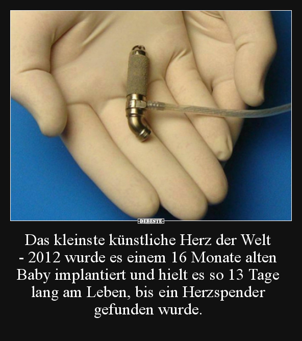 Das kleinste künstliche Herz der Welt - 2012 wurde es.. - Lustige Bilder | DEBESTE.de