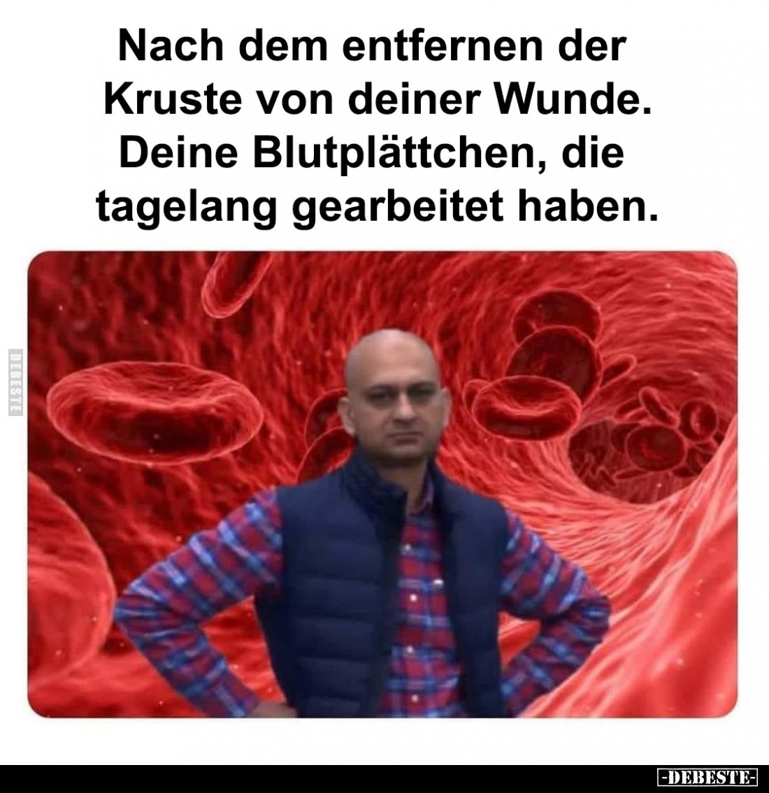 Nach dem entfernen der Kruste von deiner Wunde.
Deine Blutplättchen, die tagelang gearbeitet haben.