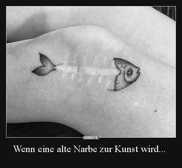 Wenn eine alte Narbe zur Kunst wird...