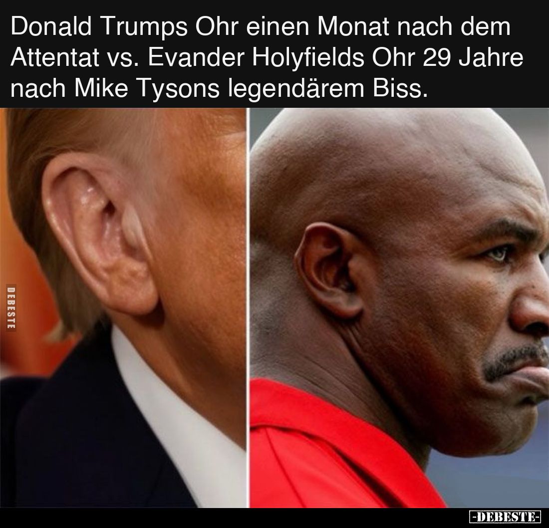 Donald Trumps Ohr einen Monat nach dem Attentat vs. Evander Holyfields Ohr 29 Jahre nach Mike Tysons legendärem Biss.