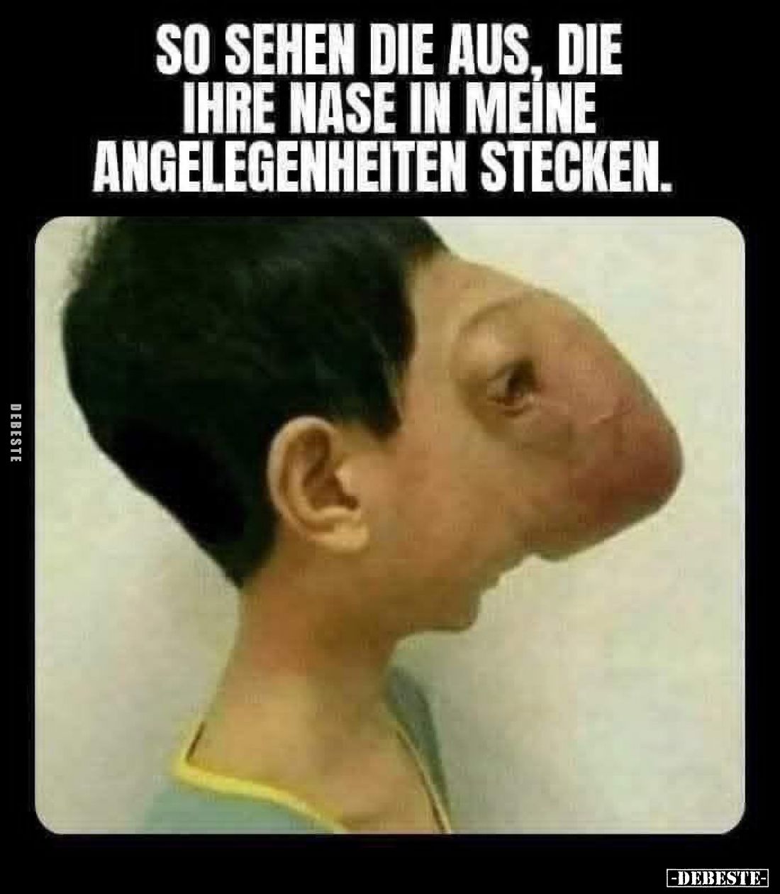 So sehen die aus, die ihre Nase in meine Angelegenheiten stecken.
