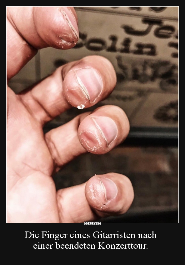 Die Finger eines Gitarristen nach einer beendeten.. - Lustige Bilder | DEBESTE.de