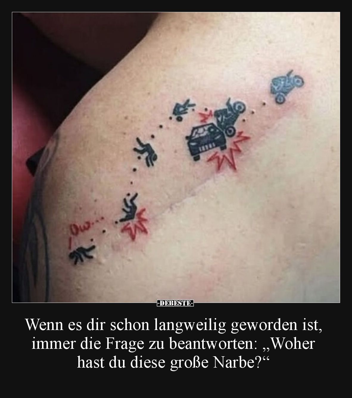 Wenn es dir schon langweilig geworden ist, immer die Frage zu beantworten: „Woher hast du diese große Narbe?“