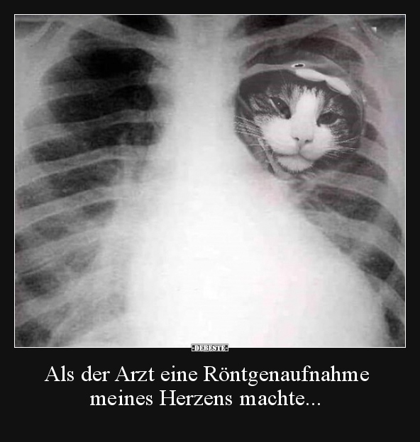 Als der Arzt eine Röntgenaufnahme meines Herzens.. - Lustige Bilder | DEBESTE.de