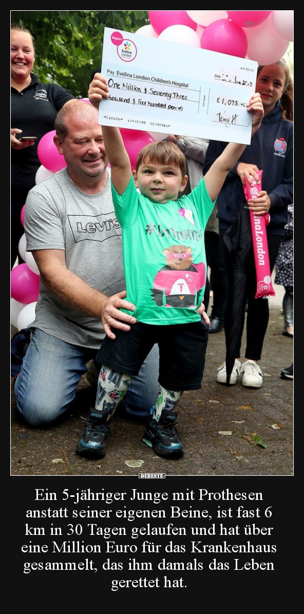 Ein 5-jähriger Junge mit Prothesen anstatt seiner eigenen..