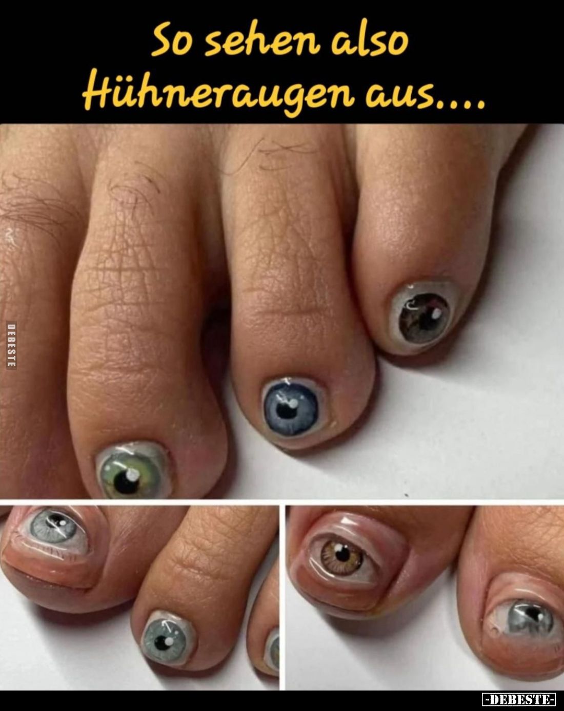 So sehen also Hühneraugen aus....