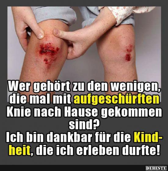 Wer gehört zu den wenigen, die mal mit aufgeschürften Knie.. - Lustige Bilder | DEBESTE.de