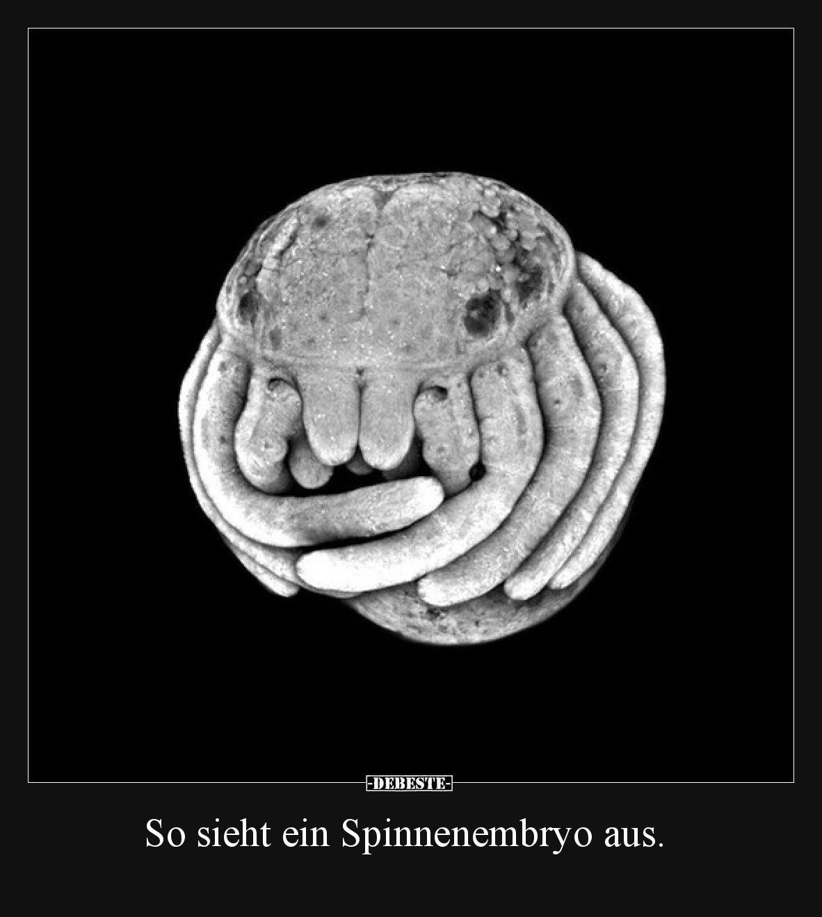 So sieht ein Spinnenembryo aus.
