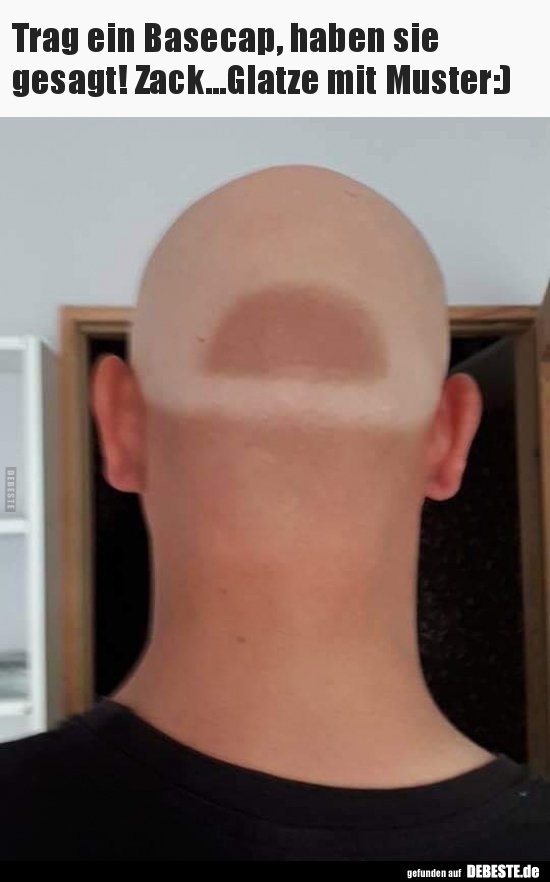  Trag ein Basecap, haben sie gesagt!..