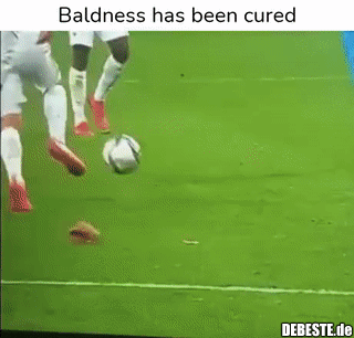 Kahlheit wurde geheilt..
