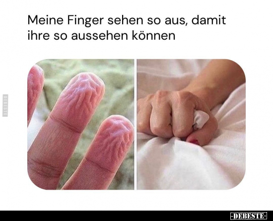 Meine Finger sehen so aus.. - Lustige Bilder | DEBESTE.de