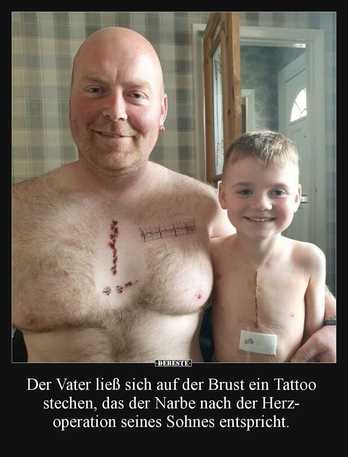 Der Vater ließ sich auf der Brust ein Tattoo stechen, das der Narbe nach der Herzoperation seines Sohnes entspricht.