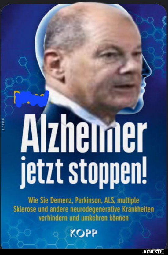 Alzheimer jetzt stoppen! Wie Sie Demenz, Parkinson, ALS.. - Lustige Bilder | DEBESTE.de