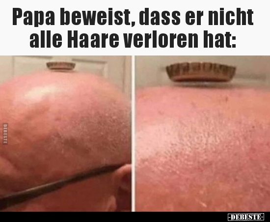 Papa beweist, dass er nicht alle Haare verloren hat..