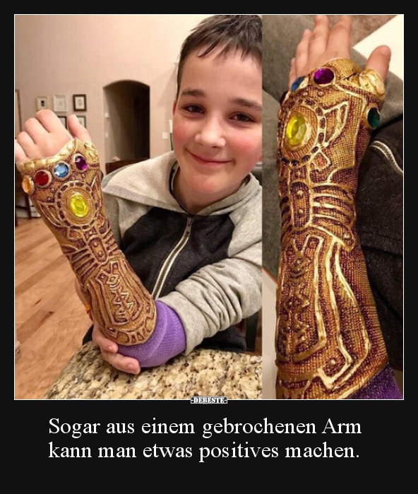 Sogar aus einem gebrochenen Arm kann man etwas positives.. - Lustige Bilder | DEBESTE.de