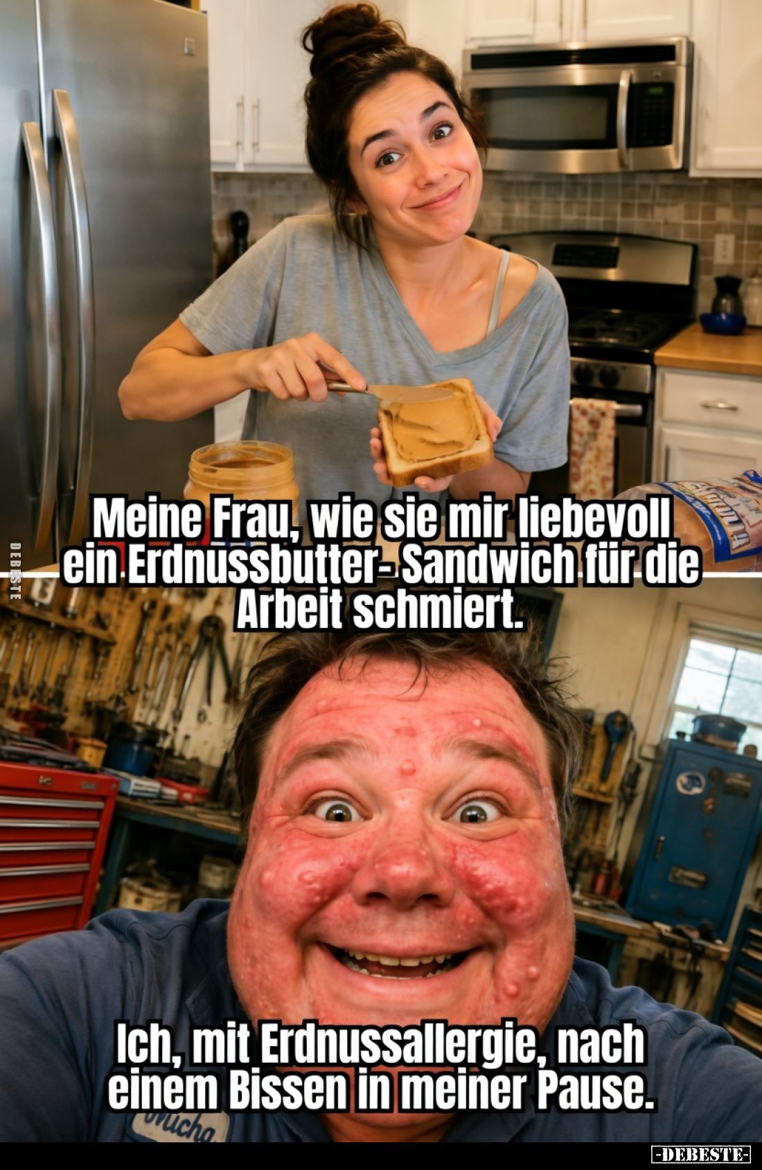 Meine Frau, wie sie mir liebevoll ein Erdnussbutter-Sandwich für die Arbeit schmiert.
Ich, mit Erdnussallergie, nach einem...