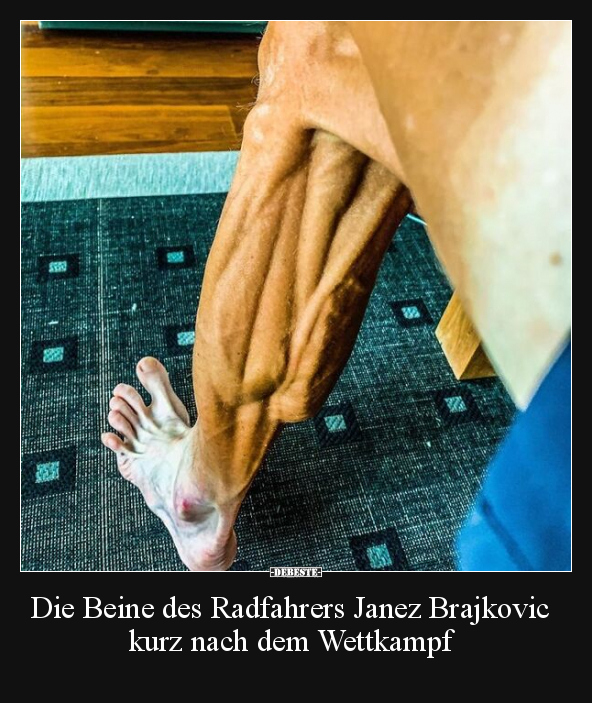 Die Beine des Radfahrers Janez Brajkovic kurz nach dem.. - Lustige Bilder | DEBESTE.de