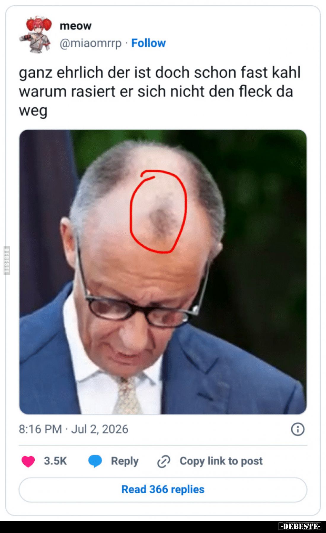 Ganz ehrlich, der ist doch schon fast kahl.

Warum rasiert er sich nicht den Fleck da weg?
