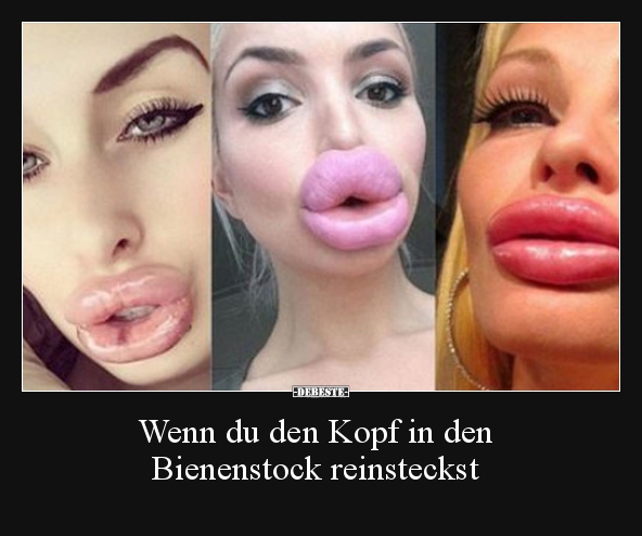 Wenn du den Kopf in den Bienenstock reinsteckst..