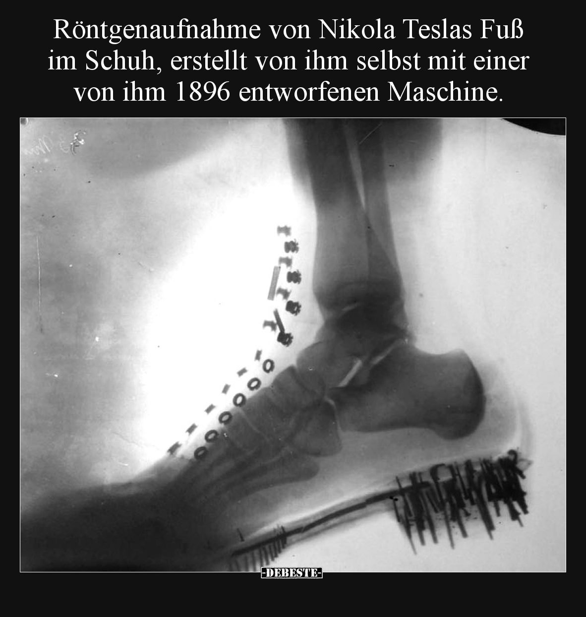 Röntgenaufnahme von Nikola Teslas Fuß im Schuh, erstellt von ihm selbst mit einer von ihm 1896 entworfenen Maschine.