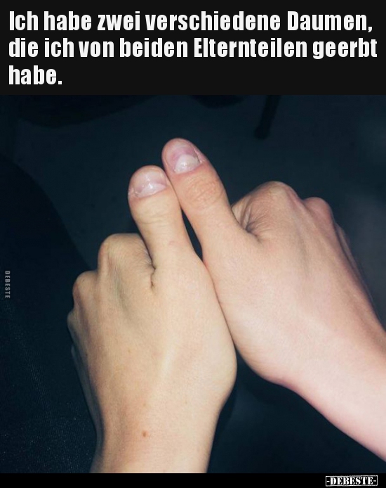 Ich habe zwei verschiedene Daumen, die ich von beiden..