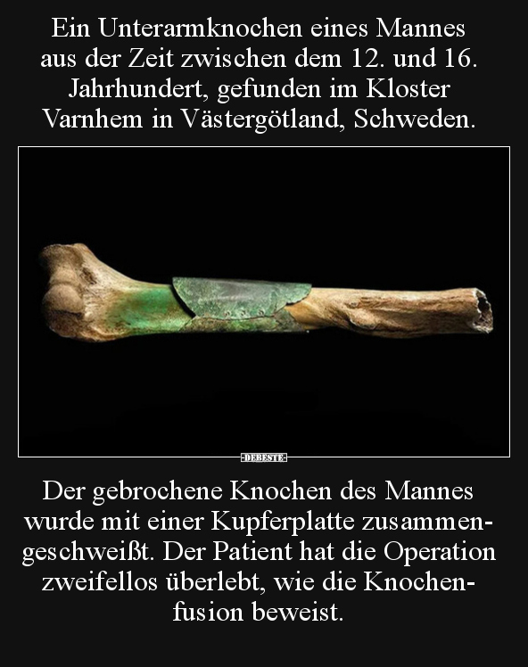 Ein Unterarmknochen eines Mannes aus der Zeit zwischen dem.. - Lustige Bilder | DEBESTE.de