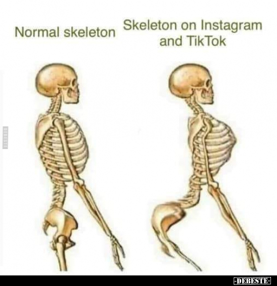 Normal Skeleton - Skeleton on Instagram and TikTok. - Lustige Bilder | DEBESTE.de