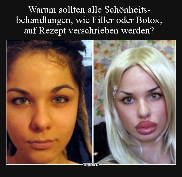 Warum sollten alle Schönheitsbehandlungen, wie Filler oder.. - Lustige Bilder | DEBESTE.de