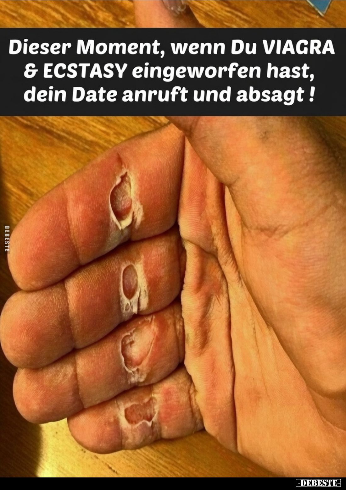 Dieser Moment, wenn Du VIAGRA & ECSTASY eingeworfen hast, dein Date anruft und absagt!