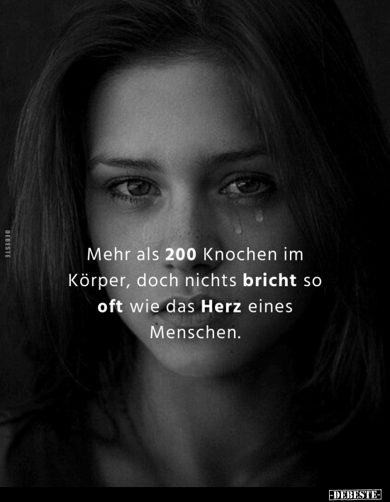 Mehr als 200 Knochen im Körper, doch nichts bricht so oft.. - Lustige Bilder | DEBESTE.de