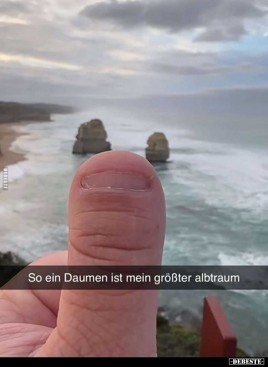 So ein Daumen ist mein größter Albtraum